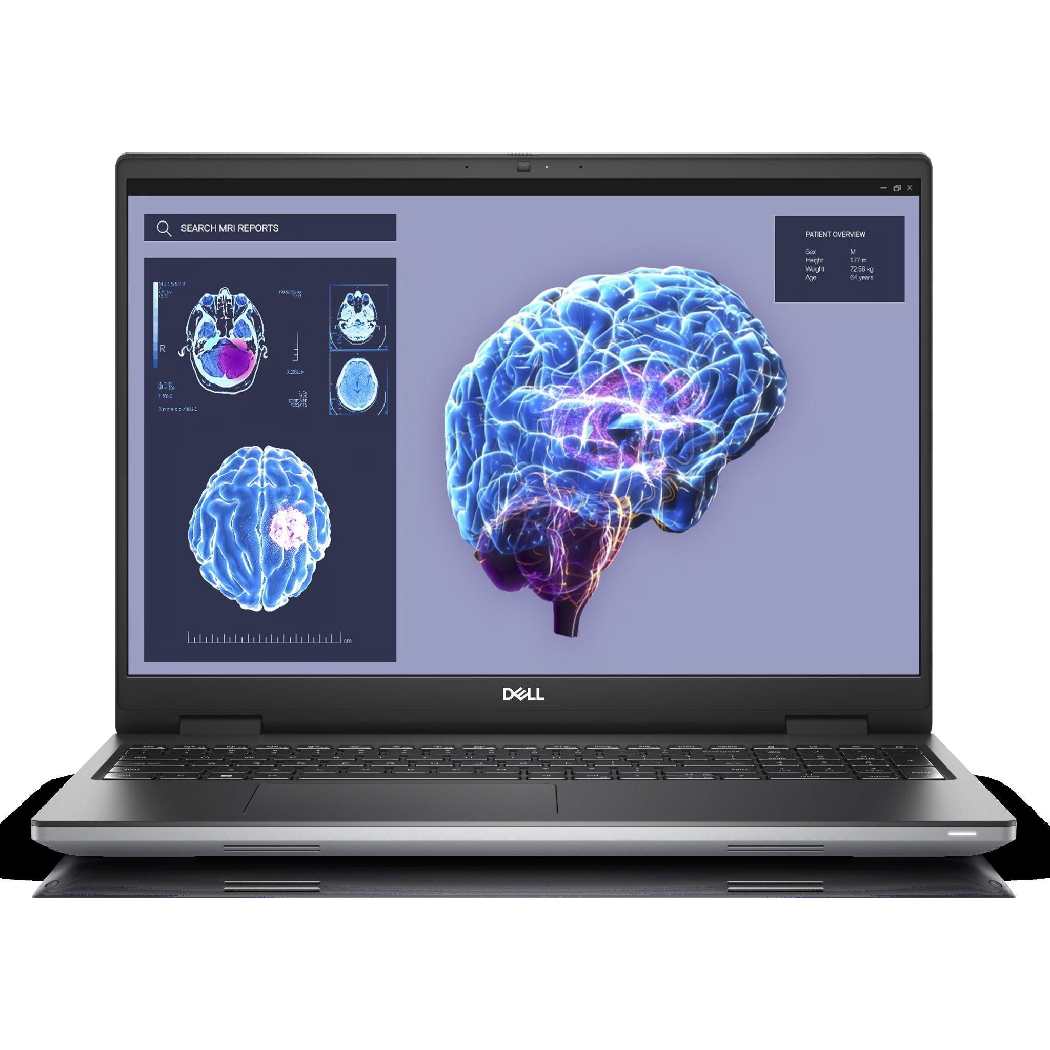6526b682e719a624d41b5e41_notebook-precision-7680-gray-gallery-10_1752057952376.jpg