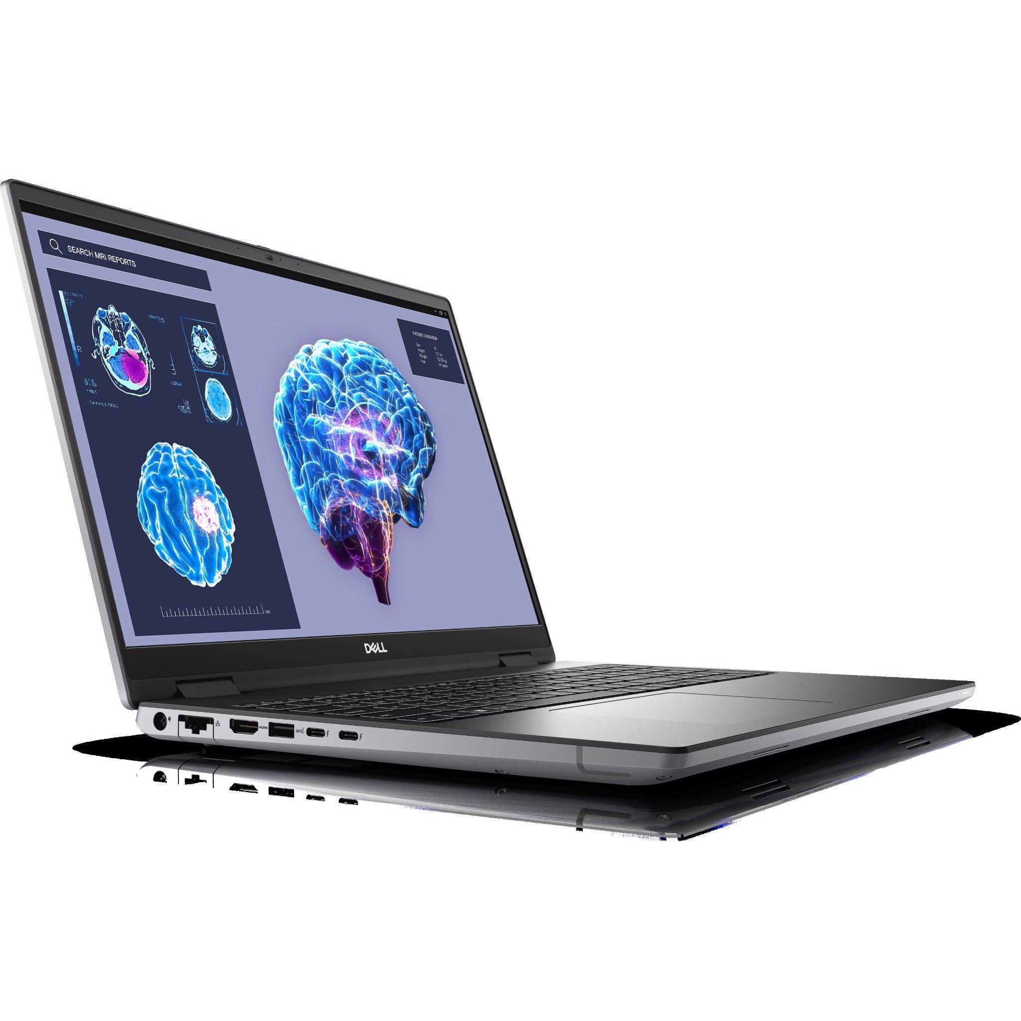 6526b682e719a624d41b5e41_notebook-precision-7680-gray-gallery-1_1752057952376.jpg