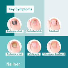 Buy Nailner,Nailner 2-in-1 Fungal Nail Treatment Brush, 5ml - Healthy & Bright Nails - Gadcet UK | UK | London | Scotland | Wales| Near Me | Cheap | Pay In 3 | Health & Beauty