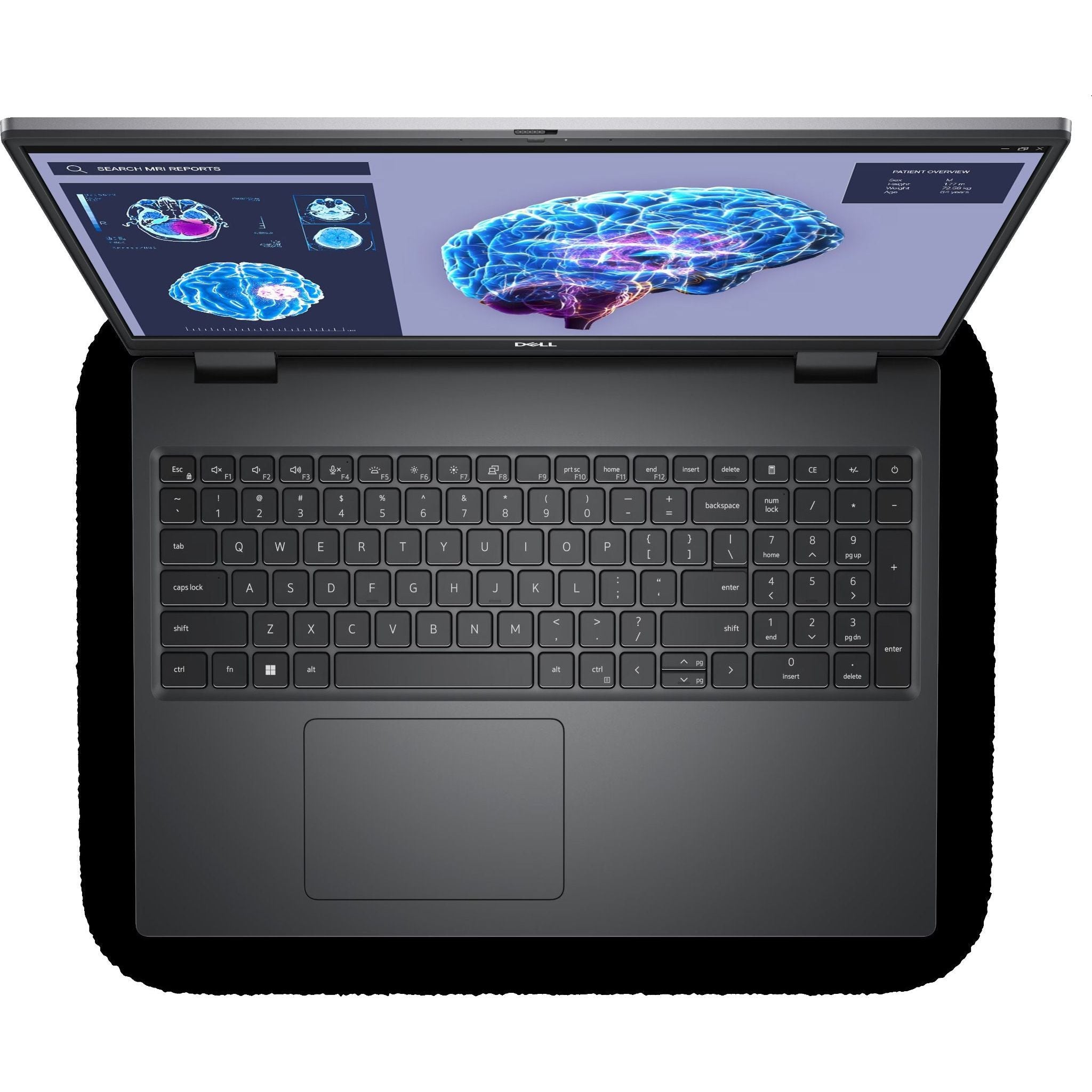 6526b682e719a624d41b5e41_notebook-precision-7680-gray-gallery-2_1752057952379.jpg