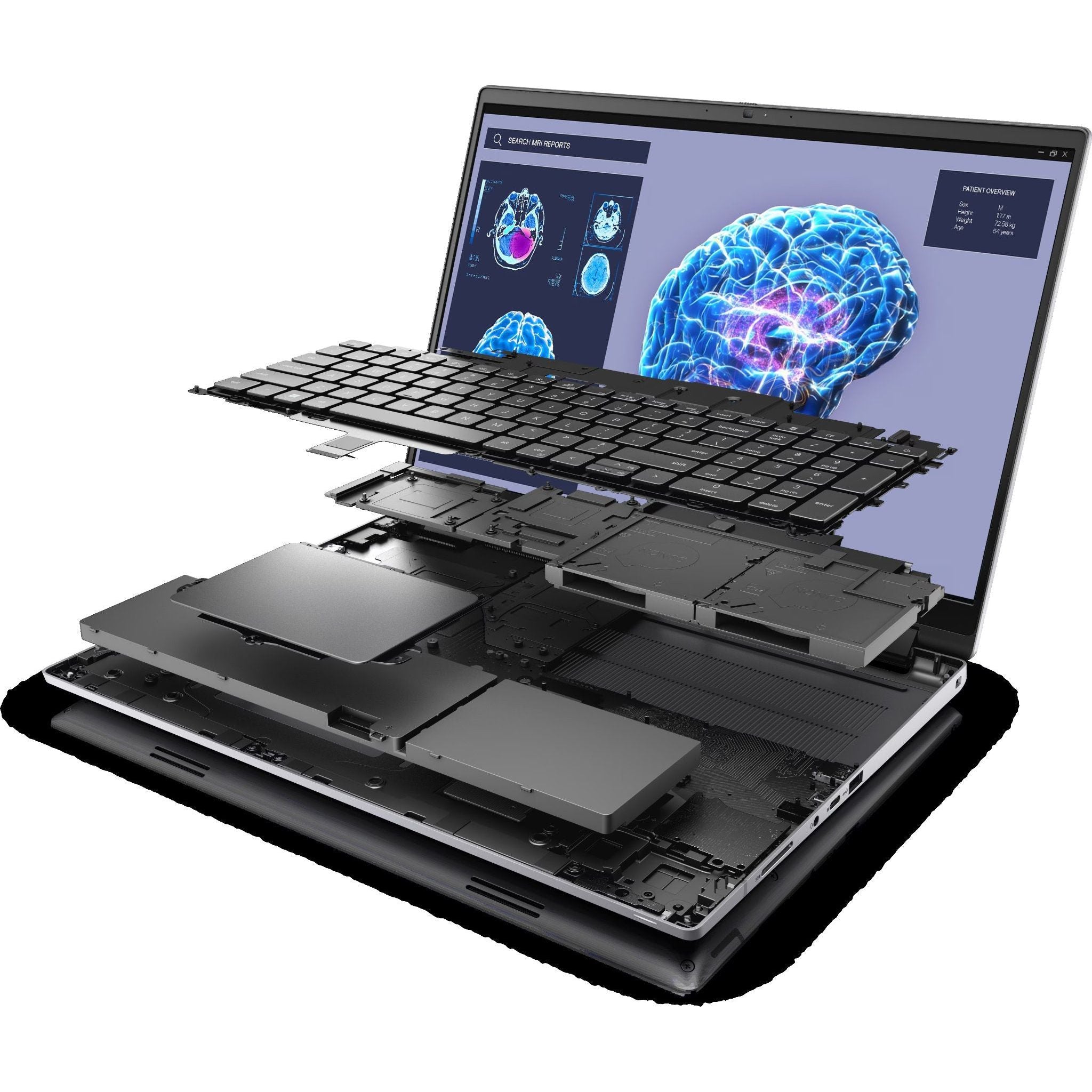6526b682e719a624d41b5e41_notebook-precision-7680-gray-gallery-9_1752057952378.jpg