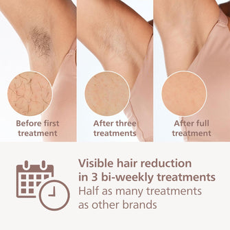 Buy Philips,Lumea IPL 9900 Series IPL Hair removal device - Gadcet UK | UK | London | Scotland | Wales| Near Me | Cheap | Pay In 3 | Hair Care