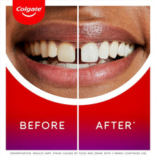 Buy Colgate,Colgate Max White Ultimate Renewal Whitening Toothpaste 75ml – Advanced Whitening & Enamel Care - Gadcet UK | UK | London | Scotland | Wales| Near Me | Cheap | Pay In 3 | Toothpaste