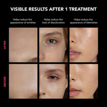 FAQ™ 202 Advanced 8-Colour LED Face Mask – 600 LED Light Points, NIR & Red Light Therapy, Flexi-Fit Silicone, App Control